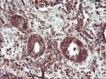TMX Antibody in Immunohistochemistry (Paraffin) (IHC (P))