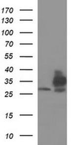 TMX Antibody in Western Blot (WB)