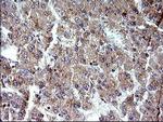 SHBG Monoclonal Antibody (OTI1D10)