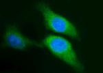 SPHK1 Monoclonal Antibody (OTI1A6)