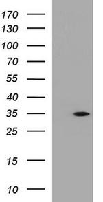 ANR49 Antibody in Western Blot (WB)