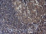 SCP2 Antibody in Immunohistochemistry (Paraffin) (IHC (P))