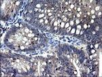 TXNDC5 Antibody in Immunohistochemistry (Paraffin) (IHC (P))