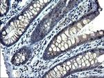 ANKMY2 Antibody in Immunohistochemistry (Paraffin) (IHC (P))