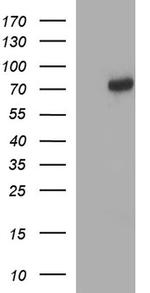 METTL25 Antibody in Western Blot (WB)