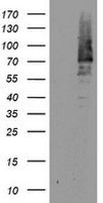 cIAP2 Antibody in Western Blot (WB)