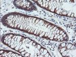 PYCARD Antibody in Immunohistochemistry (Paraffin) (IHC (P))