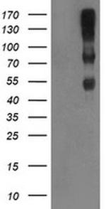 C1r Antibody in Western Blot (WB)