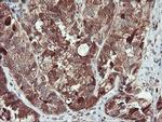 SERPINB1 Antibody in Immunohistochemistry (Paraffin) (IHC (P))