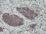 ZNF365 Antibody in Immunohistochemistry (Paraffin) (IHC (P))