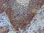 ZNF365 Antibody in Immunohistochemistry (Paraffin) (IHC (P))