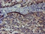 ZNF365 Antibody in Immunohistochemistry (Paraffin) (IHC (P))
