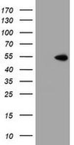 ZNF365 Antibody in Western Blot (WB)