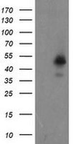 ZNF365 Antibody in Western Blot (WB)