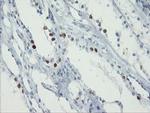 FOXI1 Antibody in Immunohistochemistry (Paraffin) (IHC (P))