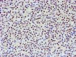 TPRKB Antibody in Immunohistochemistry (Paraffin) (IHC (P))