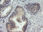 TIGD1 Antibody in Immunohistochemistry (Paraffin) (IHC (P))