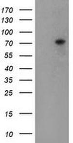 TIGD1 Antibody in Western Blot (WB)