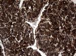 SnoN Antibody in Immunohistochemistry (Paraffin) (IHC (P))