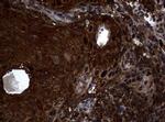 SnoN Antibody in Immunohistochemistry (Paraffin) (IHC (P))