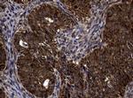 SnoN Antibody in Immunohistochemistry (Paraffin) (IHC (P))