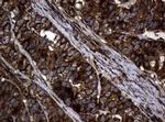 SnoN Antibody in Immunohistochemistry (Paraffin) (IHC (P))
