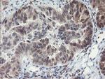 LANCL2 Antibody in Immunohistochemistry (Paraffin) (IHC (P))