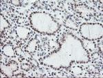 NYREN18 Antibody in Immunohistochemistry (Paraffin) (IHC (P))