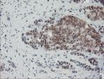 NYREN18 Antibody in Immunohistochemistry (Paraffin) (IHC (P))