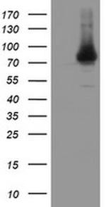 NYREN18 Antibody in Western Blot (WB)