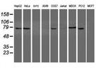 NYREN18 Antibody in Western Blot (WB)