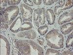 AGTPBP1 Antibody in Immunohistochemistry (Paraffin) (IHC (P))
