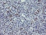 MEIS3 Antibody in Immunohistochemistry (Paraffin) (IHC (P))