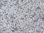 MEIS3 Antibody in Immunohistochemistry (Paraffin) (IHC (P))