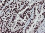 MEIS3 Antibody in Immunohistochemistry (Paraffin) (IHC (P))