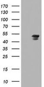 MEIS3 Antibody in Western Blot (WB)