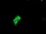 METAP2 Monoclonal Antibody (OTI1F6)