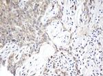 ARL2BP Monoclonal Antibody (OTI1F8)