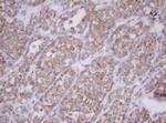 MTIF3 Monoclonal Antibody (OTI1E8)