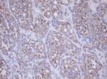 MTIF3 Monoclonal Antibody (OTI1D6)