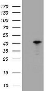 PRR11 Antibody in Western Blot (WB)