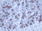 DDX59 Antibody in Immunohistochemistry (Paraffin) (IHC (P))