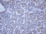 DDX59 Antibody in Immunohistochemistry (Paraffin) (IHC (P))