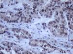 DDX59 Antibody in Immunohistochemistry (Paraffin) (IHC (P))