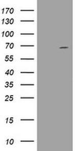 DDX59 Antibody in Western Blot (WB)