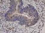 HBS1L Antibody in Immunohistochemistry (Paraffin) (IHC (P))