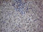 TIA-1 Antibody in Immunohistochemistry (Paraffin) (IHC (P))