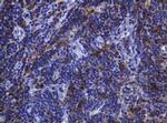 SOAT2 Antibody in Immunohistochemistry (Paraffin) (IHC (P))