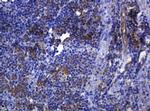 SOAT2 Antibody in Immunohistochemistry (Paraffin) (IHC (P))