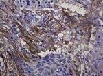SOAT2 Antibody in Immunohistochemistry (Paraffin) (IHC (P))